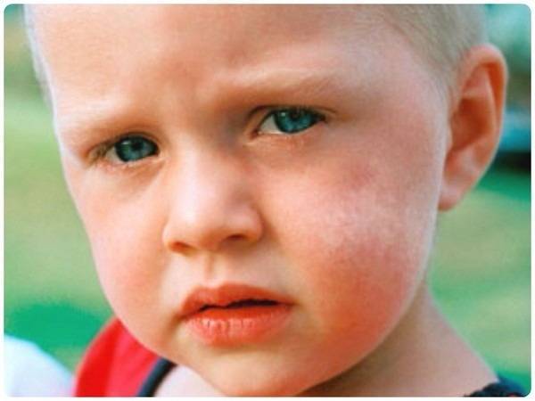 Пятна на теле (красные, коричневые, белые, розовые) – виды пятен на коже, причины, лечение