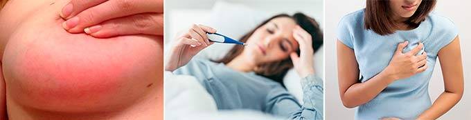 Кормящая мама простудила грудь (продуло грудную железу при кормлении): лечение