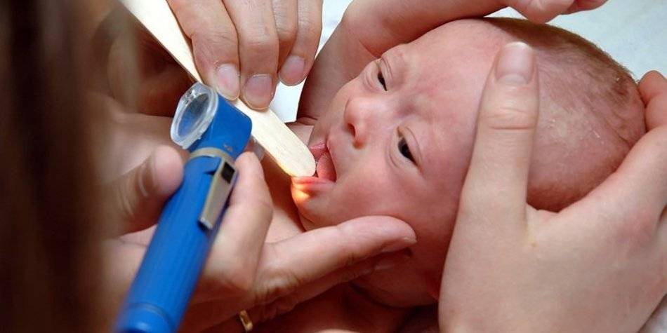 Ангина у грудничка: симптомы и лечение, разновидности заболевания у детей до года