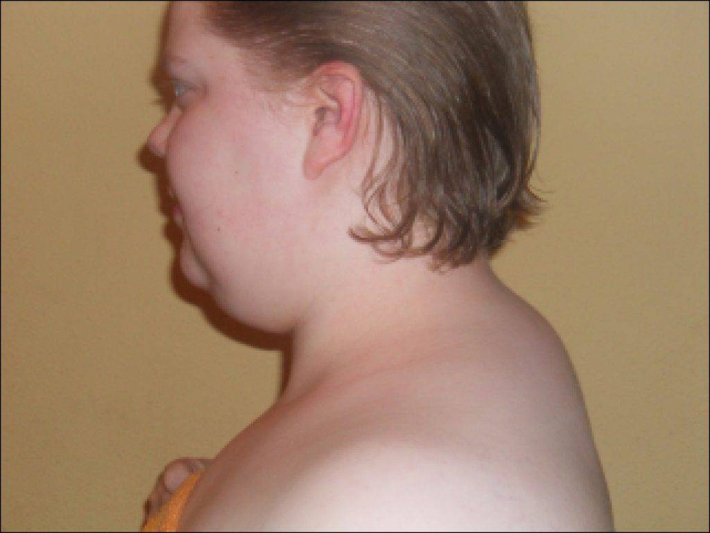 Шишка на голове у ребенка - что это может быть?