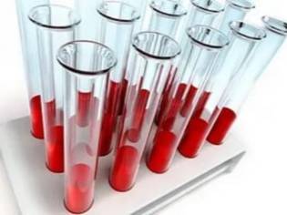 Анализ на мононуклеоз у детей - расшифровка показателей исследования крови