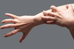 Аллергия на витамин Д у грудничков: фото, симптомы, может ли быть негативная реакция у детей?