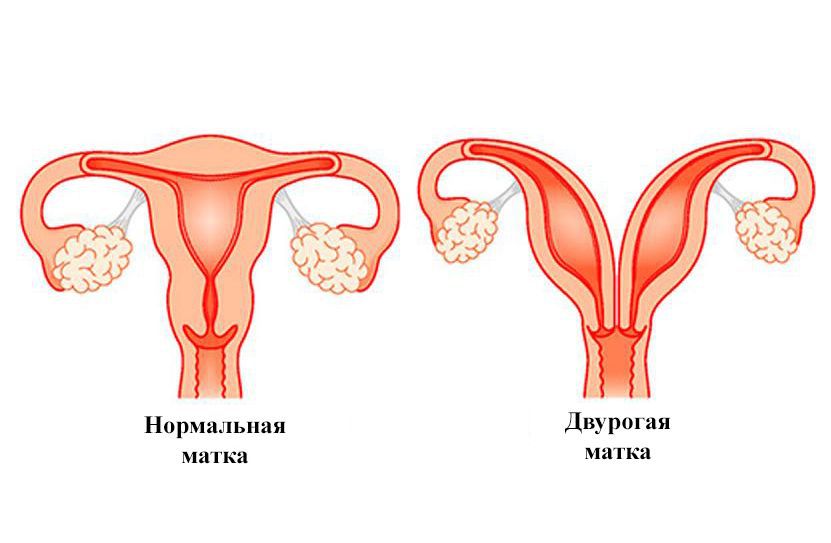 Беременность и роды при опущении шейки матки