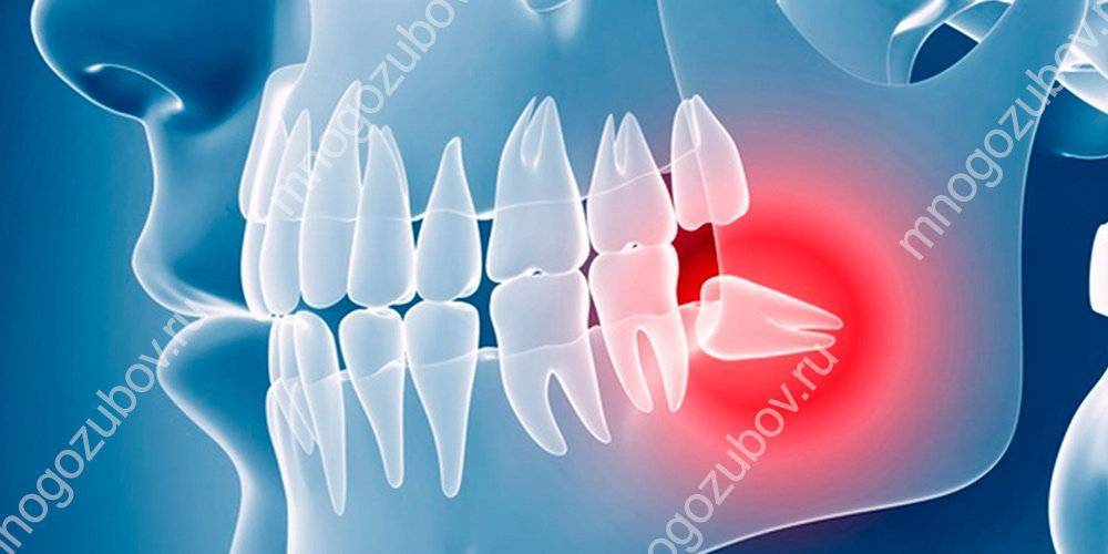 Молочные зубы у детей: схема и сроки выпадения, прорезывания по возрасту (таблица)