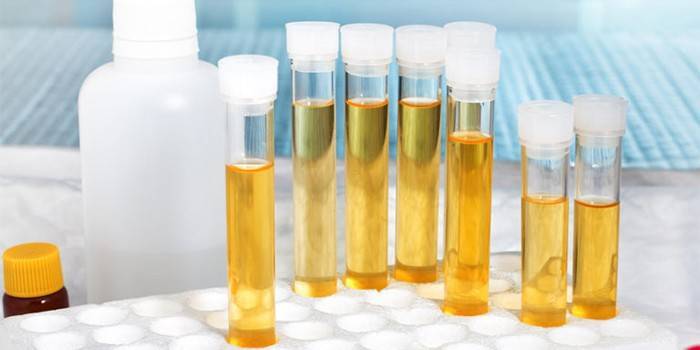 Нитриты в моче у ребенка - что это значит, каковы причины патологии и нужно ли ее лечить?