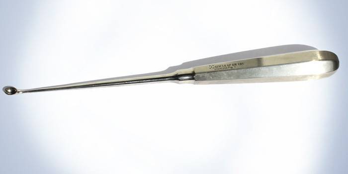 Контагиозный моллюск у детей: фото на коже, лечение и удаление на разных стадиях болезни