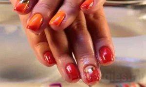 Аллергия у ребенка: фото, симптомы и лечение, профилактика кожных аллергических реакций