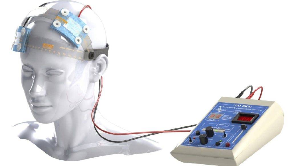 Микрополяризация головного мозга детям: показания и противопоказания курса ТКМП