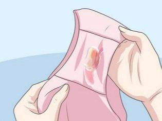 Бежевые выделения при беременности на ранних сроках светлого, желтого или коричневого оттенка